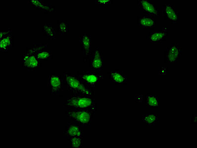 Immunofluorescent analysis of Hela cells treated with NaB using CSB-PA010429OA05acHU at dilution of 1:100 and Alexa Fluor 488-congugated AffiniPure Goat Anti-Rabbit IgG(H+L)