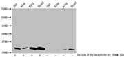 Western Blot Detected samples: 293 whole cell lysate, A549 whole cell lysate, K562 whole cell lysate, HepG2 whole cell lysate; Untreated (-) or treated (+) with 50mM sodium 3-hydroxybutyrate for 72h All lanes: HIST1H4A antibody at 1:1000 Secondary...