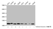 Western Blot Detected samples: Hela whole cell lysate, Jurkat whole cell lysate, 293 whole cell lysate, HepG2 whole cell lysate; Untreated (-) or treated (+) with 30mM sodium butyrate for 4h All lanes: HIST1H4A antibody at 1:1000 Secondary Goat po...