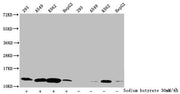 Western Blot Detected samples: 293 whole cell lysate, A549 whole cell lysate, K562 whole cell lysate, HepG2 whole cell lysate; Untreated (-) or treated (+) with 30mM sodium butyrate for 4h All lanes: HIST1H4A antibody at 1:2000 Secondary Goat poly...