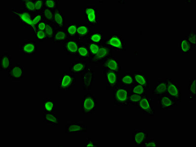 Immunofluorescence staining of Hela cells with CSB-PA010429OA05me1HU at 1:2.5, counter-stained with DAPI. The cells were fixed in 4% formaldehyde, permeabilized using 0.2% Triton X-100 and blocked in 10% normal Goat Serum. The cells were then incu...