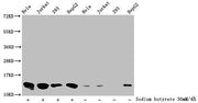 Western Blot Detected samples: Hela whole cell lysate, Jurkat whole cell lysate, 293 whole cell lysate, HepG2 whole cell lysate; Untreated (-) or treated (+) with 30mM sodium butyrate for 4h All lanes: HIST1H4A antibody at 1:2000 Secondary Goat po...