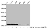 Western Blot Detected samples: 293 whole cell lysate, A549 whole cell lysate, K562 whole cell lysate; Untreated (-) or treated (+) with 30mM sodium butyrate for 4h All lanes: HIST1H4A antibody at 1:100 Secondary Goat polyclonal to rabbit IgG at 1/...