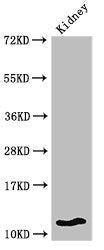 Western Blot Positive WB detected in: Mouse kidney tissue All lanes: HIST1H4A antibody at 2µg/ml Secondary Goat polyclonal to rabbit IgG at 1/50000 dilution Predicted band size: 12 kDa Observed band size: 12 kDa