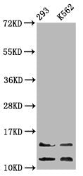 Western Blot Positive WB detected in: 293 whole cell lysate, K562 whole cell lysate All lanes: HIST1H4A antibody at 0.86µg/ml Secondary Goat polyclonal to rabbit IgG at 1/50000 dilution Predicted band size: 12 kDa Observed band size: 12, 14 kDa