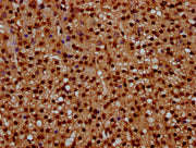 IHC image of CSB-PA010429OA08npropHU diluted at 1:10 and staining in paraffin-embedded human adrenal gland tissue performed on a Leica BondTM system. After dewaxing and hydration, antigen retrieval was mediated by high pressure in a citrate buffer...