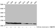 Western Blot Detected samples: Hela whole cell lysate, A549 whole cell lysate, 293 whole cell lysate, K562 whole cell lysate; Untreated (-) or treated (+) with 10mM sodium propionate for 4h All lanes: HIST1H4A antibody at 1:2000 Secondary Goat pol...