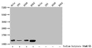 Western Blot Detected samples: Hela whole cell lysate, 293 whole cell lysate, A549 whole cell lysate, K562 whole cell lysate; Untreated (-) or treated (+) with 30mM sodium butyrate for 4h All lanes: HIST1H4A antibody at 1:2000 Secondary Goat polyc...