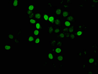 Immunofluorescence staining of Hela cells with CSB-PA010429OA12nsucHU at 1:2.5, counter-stained with DAPI. The cells were fixed in 4% formaldehyde, permeabilized using 0.2% Triton X-100 and blocked in 10% normal Goat Serum. The cells were then inc...