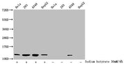 Western Blot Detected samples: Hela whole cell lysate, 293 whole cell lysate, A549 whole cell lysate, HepG2 whole cell lysate; Untreated (-) or treated (+) with 30mM sodium butyrate for 4h All lanes: HIST1H4A antibody at 1:2000 Secondary Goat poly...