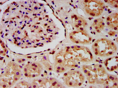 IHC image of CSB-PA010429OA16ncrHU diluted at 1:5 and staining in paraffin-embedded human kidney tissue performed on a Leica BondTM system. After dewaxing and hydration, antigen retrieval was mediated by high pressure in a citrate buffer (pH 6.0)....
