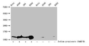 Western Blot Detected samples: Hela whole cell lysate, A549 whole cell lysate, 293 whole cell lysate, K562 whole cell lysate; Untreated (-) or treated (+) with 10mM sodium propionate for 4h All lanes: HIST1H4A antibody at 1:100 Secondary Goat poly...