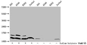 Western Blot Detected samples: 293 whole cell lysate, A549 whole cell lysate, K562 whole cell lysate, Jurkat whole cell lysate; Untreated (-) or treated (+) with 30mM sodium butyrate for 4h All lanes: HIST1H4A antibody at 1:100 Secondary Goat poly...