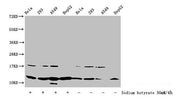 Western Blot Detected samples: Hela whole cell lysate, 293 whole cell lysate, A549 whole cell lysate, HepG2 whole cell lysate; Untreated (-) or treated (+) with 30mM sodium butyrate for 4h All lanes: HIST1H4A antibody at 1:100 Secondary Goat polyc...