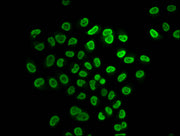 Immunofluorescence staining of Hela cells (treated with 30mM sodium butyrate for 4h) with CSB-PA010429OA31butHU at 1:25, counter-stained with DAPI. The cells were fixed in 4% formaldehyde, permeabilized using 0.2% Triton X-100 and blocked in 10% n...