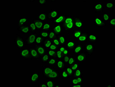 Immunofluorescence staining of Hela cells (treated with 30mM sodium butyrate for 4h) with CSB-PA010429OA31butHU at 1:25, counter-stained with DAPI. The cells were fixed in 4% formaldehyde, permeabilized using 0.2% Triton X-100 and blocked in 10% n...