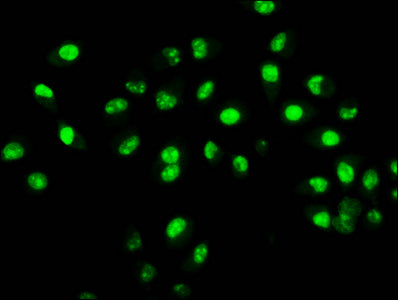 Immunofluorescence staining of Hela cells with CSB-PA010429OA31nbhbHU at 1:25, counter-stained with DAPI. The cells were fixed in 4% formaldehyde, permeabilized using 0.2% Triton X-100 and blocked in 10% normal Goat Serum. The cells were then incu...