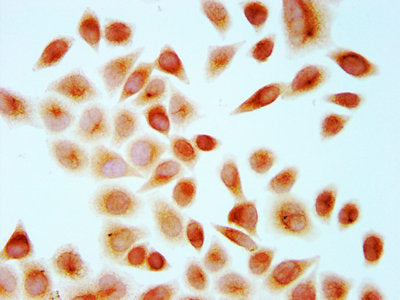 Immunocytochemistry analysis of CSB-PA010429OA67me1HU diluted at 1:10 and staining in Hela cells performed on a Leica BondTM system. The cells were fixed in 4% formaldehyde, permeabilized using 0.2% Triton X-100 and blocked with 10% normal goat se...