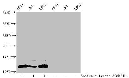 Western Blot Detected samples: A549 whole cell lysate, 293 whole cell lysate, K562 whole cell lysate; Untreated (-) or treated (+) with 30mM sodium butyrate for 4h All lanes: HIST1H4A antibody at 1:100 Secondary Goat polyclonal to rabbit IgG at 1/...