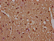 IHC image of CSB-PA010429OA77nbhbHU diluted at 1:20 and staining in paraffin-embedded human brain tissue performed on a Leica BondTM system. After dewaxing and hydration, antigen retrieval was mediated by high pressure in a citrate buffer (pH 6.0)...