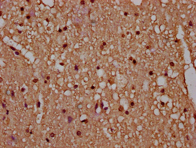 IHC image of CSB-PA010429OA77nbhbHU diluted at 1:20 and staining in paraffin-embedded human brain tissue performed on a Leica BondTM system. After dewaxing and hydration, antigen retrieval was mediated by high pressure in a citrate buffer (pH 6.0)...