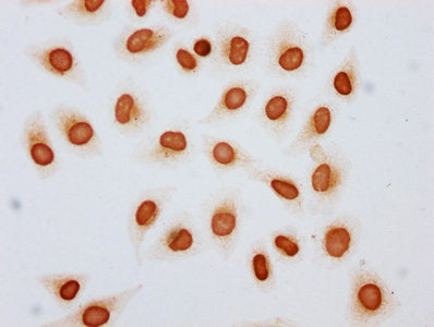 Immunocytochemistry analysis of CSB-PA010429OA79acHU diluted at 1:10 and staining in Hela cells (treated with 30mM sodium butyrate for 4h) performed on a Leica BondTM system. The cells were fixed in 4% formaldehyde, permeabilized using 0.2% Triton...