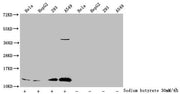 Western Blot Detected samples: Hela whole cell lysate, HepG2 whole cell lysate, 293 whole cell lysate, A549 whole cell lysate; Untreated (-) or treated (+) with 30mM sodium butyrate for 4h All lanes: HIST1H4A antibody at 1:1000 Secondary Goat poly...