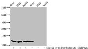 Western Blot Detected samples: Hela whole cell lysate, A549 whole cell lysate, HepG2 whole cell lysate; Untreated (-) or treated (+) with 50mM Sodium 3-hydroxybutyrate for 72h All lanes: HIST1H4A antibody at 1:100 Secondary Goat polyclonal to rabb...
