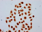 Immunocytochemistry analysis of CSB-PA010429OA91forHU diluted at 1:30 and staining in Hela cells (treated with 30mM sodium butyrate for 4h) performed on a Leica BondTM system. The cells were fixed in 4% formaldehyde, permeabilized using 0.2% Trito...