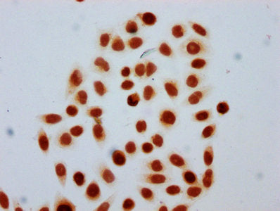 Immunocytochemistry analysis of CSB-PA010429OA91forHU diluted at 1:30 and staining in Hela cells (treated with 30mM sodium butyrate for 4h) performed on a Leica BondTM system. The cells were fixed in 4% formaldehyde, permeabilized using 0.2% Trito...
