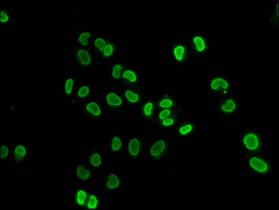 Immunofluorescence staining of Hela cells (treated with 30mM sodium butyrate for 4h) with CSB-PA010429OA91hibHU at 1:50, counter-stained with DAPI. The cells were fixed in 4% formaldehyde, permeabilized using 0.2% Triton X-100 and blocked in 10% n...