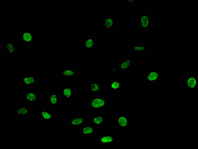 Immunofluorescent analysis of Hela cells using CSB-PA010429PA03me1HU at dilution of 1:100 and Alexa Fluor 488-congugated AffiniPure Goat Anti-Rabbit IgG(H+L)