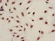 Immunocytochemistry analysis of Hela cells using CSB-PA010429PA08acHU at dilution of 1:100