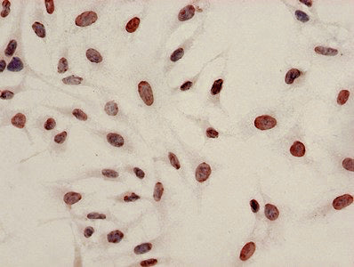 Immunocytochemistry analysis of Hela cells using CSB-PA010429PA08acHU at dilution of 1:100
