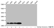 Western Blot Detected samples: Hela whole cell lysate, A549 whole cell lysate, K562 whole cell lysate, HepG2 whole cell lysate; Untreated (-) or treated (+) with 30mM sodium butyrate for 4h All lanes: HIST1H4A antibody at 1.25µg/ml Secondary Goat...