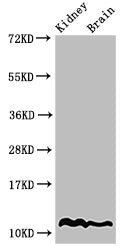 Western Blot Positive WB detected in: Mouse kidney tissue, Mouse brain tissue All lanes: HIST1H4A antibody at 2µg/ml Secondary Goat polyclonal to rabbit IgG at 1/50000 dilution Predicted band size: 12 kDa Observed band size: 12 kDa
