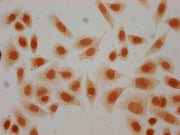 Immunocytochemistry analysis of CSB-PA010429PA44hibHU diluted at 1:20 and staining in Hela cells(treated with 30mM sodium butyrate for 4h) performed on a Leica BondTM system. The cells were fixed in 4% formaldehyde, permeabilized using 0.2% Triton...