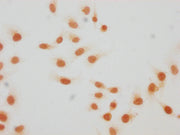 Immunocytochemistry analysis of CSB-PA010429PA59hibHU diluted at 1:20 and staining in Hela cells(treated with 30mM sodium butyrate for 4h) performed on a Leica BondTM system. The cells were fixed in 4% formaldehyde, permeabilized using 0.2% Triton...