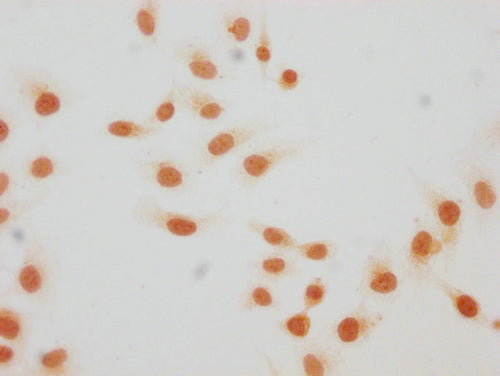 Immunocytochemistry analysis of CSB-PA010429PA59hibHU diluted at 1:20 and staining in Hela cells(treated with 30mM sodium butyrate for 4h) performed on a Leica BondTM system. The cells were fixed in 4% formaldehyde, permeabilized using 0.2% Triton...