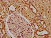 IHC image of CSB-PA010429PA59nme1HU diluted at 1:20 and staining in paraffin-embedded human kidney tissue performed on a Leica BondTM system. After dewaxing and hydration, antigen retrieval was mediated by high pressure in a citrate buffer (pH 6.0...