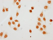 Immunocytochemistry analysis of CSB-PA010429PA77acHU diluted at 1:10 and staining in Hela cells(treated with 30mM sodium butyrate for 4h) performed on a Leica BondTM system. The cells were fixed in 4% formaldehyde, permeabilized using 0.2% Triton...
