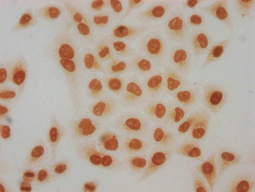 Immunocytochemistry analysis of CSB-PA010429PA91acHU diluted at 1:50 and staining in Hela cells(treated with 30mM sodium butyrate for 4h) performed on a Leica BondTM system. The cells were fixed in 4% formaldehyde, permeabilized using 0.2% Triton...