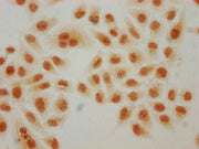 Immunocytochemistry analysis of CSB-PA010429PA91hibHU diluted at 1:150 and staining in Hela cells(treated with 30mM sodium butyrate for 4h) performed on a Leica BondTM system. The cells were fixed in 4% formaldehyde, permeabilized using 0.2% Trito...