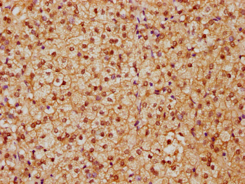 IHC image of CSB-PA010429PA91nhibHU diluted at 1:20 and staining in paraffin-embedded human adrenal gland tissue performed on a Leica BondTM system. After dewaxing and hydration, antigen retrieval was mediated by high pressure in a citrate buffer...