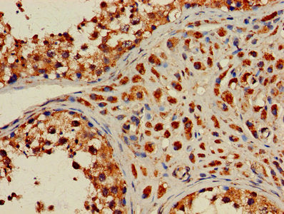 Immunohistochemistry of paraffin-embedded human testis tissue using CSB-PA010445LA01HU at dilution of 1:100