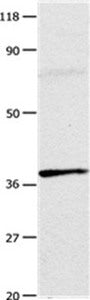 Gel: 10%SDS-PAGE Lysates (from left to right): Mouse testis tissue Amount of lysate: 20ug per lane Primary antibody: 1/100 dilution Secondary antibody dilution: 1/8000 Exposure time: 1 minute