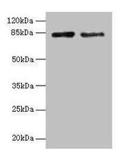 Western blot All lanes: HJURP antibody at 12µg/ml Lane 1: Jurkat whole cell lysate Lane 2: Hela whole cell lysate Secondary Goat polyclonal to rabbit IgG at 1/10000 dilution Predicted band size: 84, 78, 75 kDa Observed band size: 84 kDa