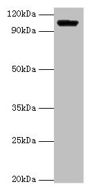 Western blot All lanes: HK1 antibody at 2µg/ml + Rat brain tissue Secondary Goat polyclonal to rabbit IgG at 1/15000 dilution Predicted band size: 103, 102 kDa Observed band size: 103 kDa