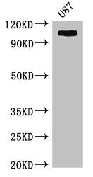 Western Blot Positive WB detected in: U87 whole cell lysate All lanes: HK2 antibody at 4µg/ml Secondary Goat polyclonal to rabbit IgG at 1/50000 dilution Predicted band size: 103 kDa Observed band size: 103 kDa