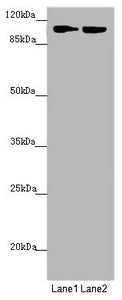 Western blot All lanes: HK3 antibody at 1.47 ug/ml Lane 1: Mouse liver tissue Lane 2: Mouse kidney tissue Secondary Goat polyclonal to rabbit IgG at 1/10000 dilution Predicted band size: 99 kDa Observed band size: 99 kDa